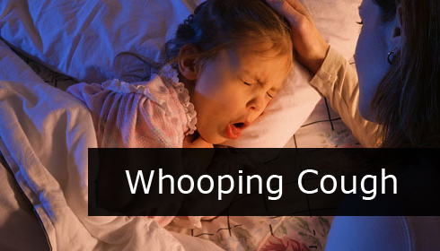 What is Whooping Cough? -Symptoms & Signs,Vaccine of whooping cough